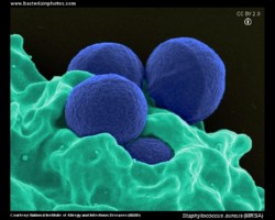 Staphylococcus aureus MRSA SEM micrograph